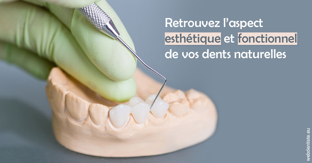 https://dr-monlouis-deva-michele-sandra.chirurgiens-dentistes.fr/Restaurations dentaires 1