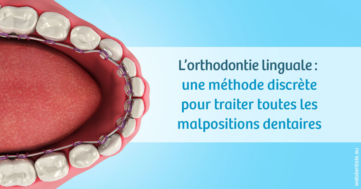 https://dr-monlouis-deva-michele-sandra.chirurgiens-dentistes.fr/L'orthodontie linguale 1