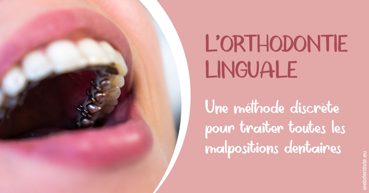 https://dr-monlouis-deva-michele-sandra.chirurgiens-dentistes.fr/L'orthodontie linguale 2