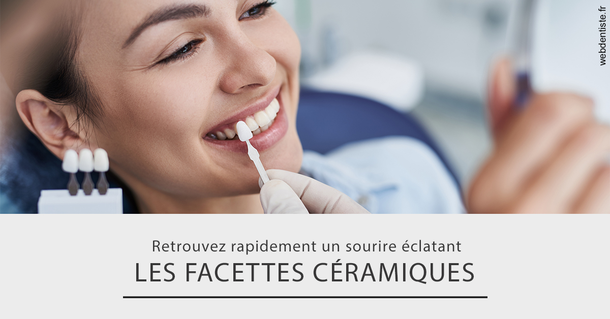 https://dr-monlouis-deva-michele-sandra.chirurgiens-dentistes.fr/Les facettes céramiques 2