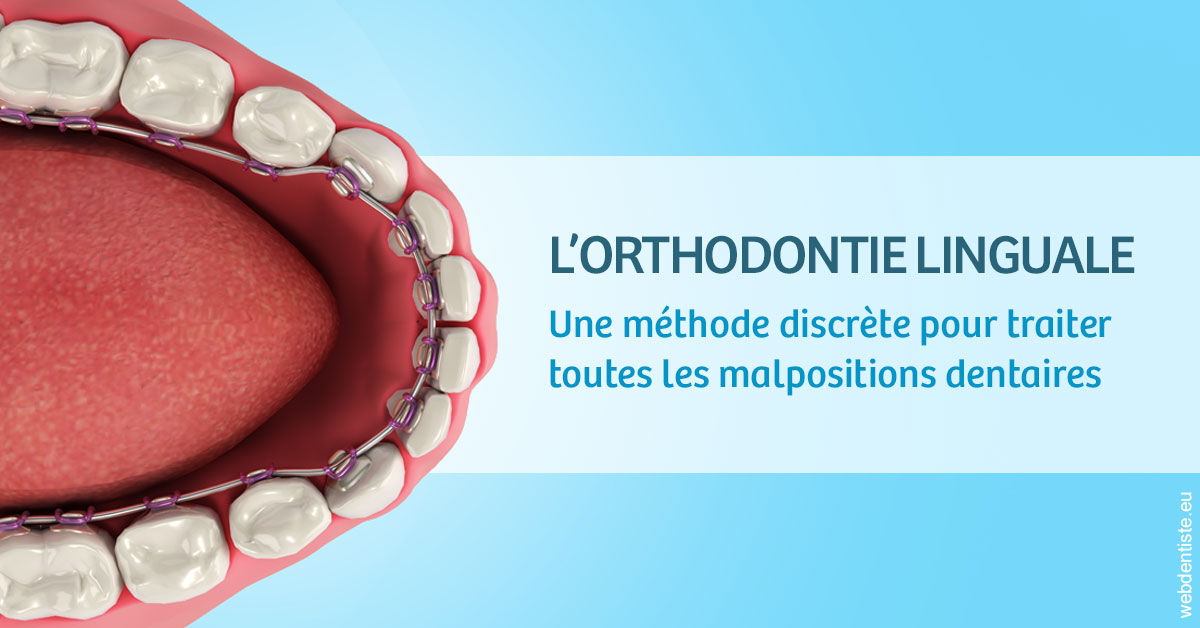 https://dr-monlouis-deva-michele-sandra.chirurgiens-dentistes.fr/L'orthodontie linguale 1