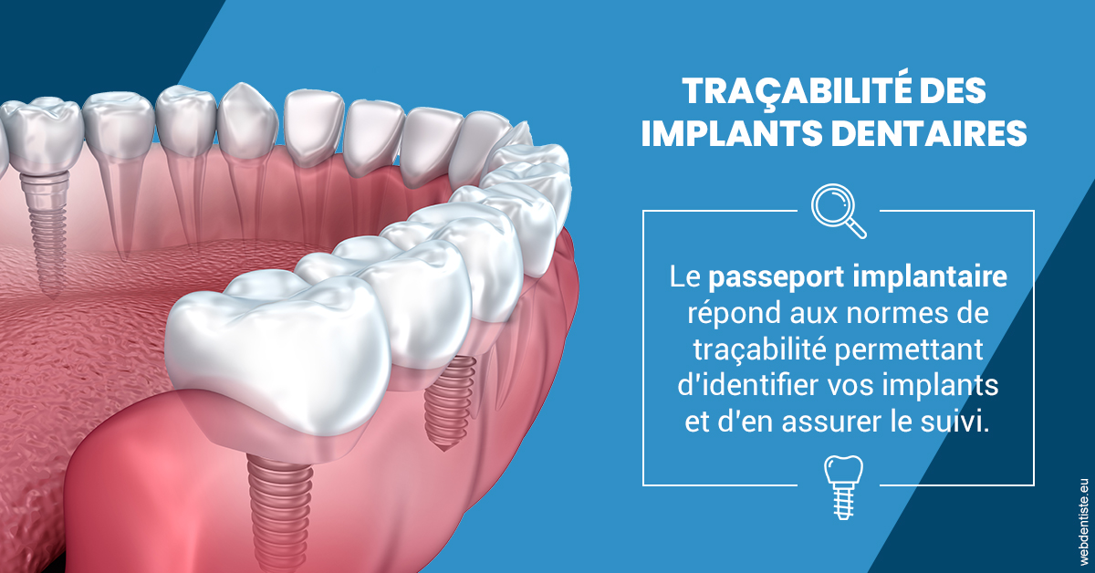 https://dr-monlouis-deva-michele-sandra.chirurgiens-dentistes.fr/T2 2023 - Traçabilité des implants 1