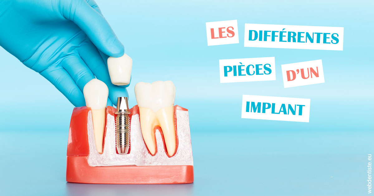 https://dr-monlouis-deva-michele-sandra.chirurgiens-dentistes.fr/Les différentes pièces d’un implant 2