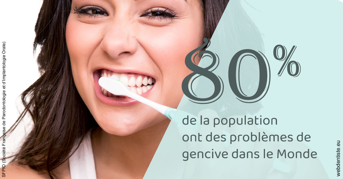 https://dr-monlouis-deva-michele-sandra.chirurgiens-dentistes.fr/Problèmes de gencive 1