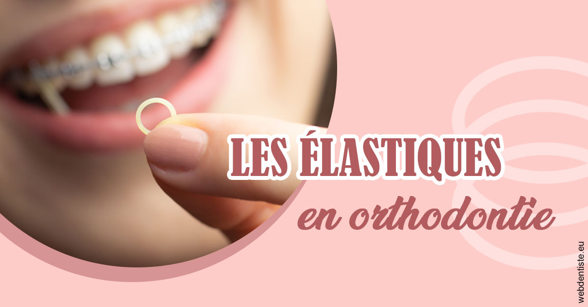 https://dr-monlouis-deva-michele-sandra.chirurgiens-dentistes.fr/Elastiques orthodontie 1