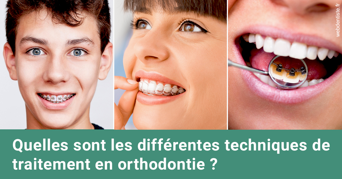 https://dr-monlouis-deva-michele-sandra.chirurgiens-dentistes.fr/Les différentes techniques de traitement 2