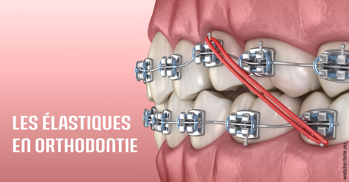 https://dr-monlouis-deva-michele-sandra.chirurgiens-dentistes.fr/Elastiques orthodontie 2