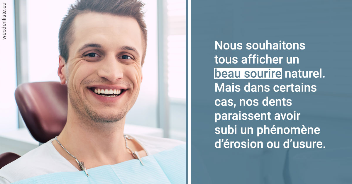 https://dr-monlouis-deva-michele-sandra.chirurgiens-dentistes.fr/Érosion et usure dentaire