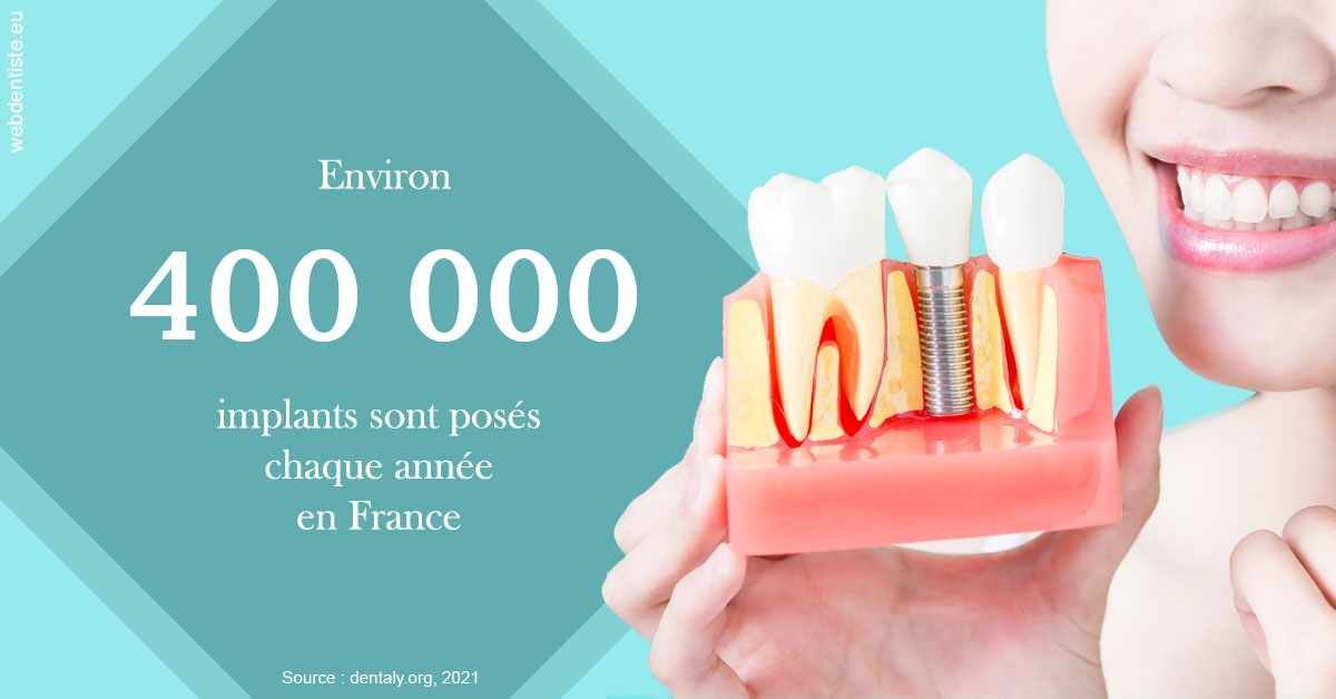 https://dr-monlouis-deva-michele-sandra.chirurgiens-dentistes.fr/Pose d'implants en France 2